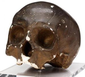 Cast of skull of Corporal John Shaw 2nd Life Guards killed at the Battle of Waterloo on 18th June 1815